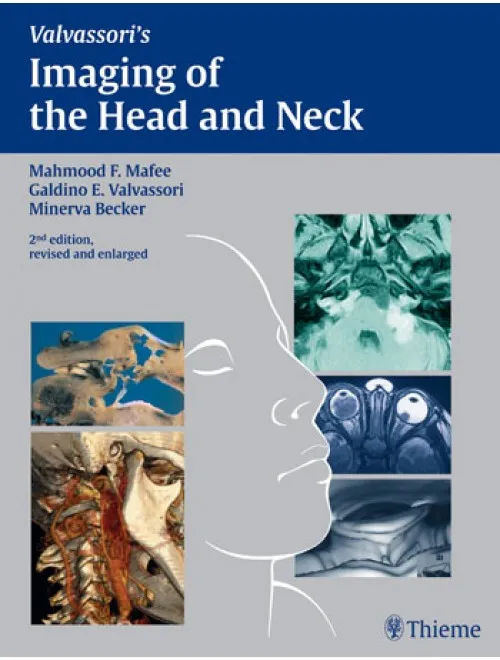 Imaging of the Head and Neck - 2nd Edition