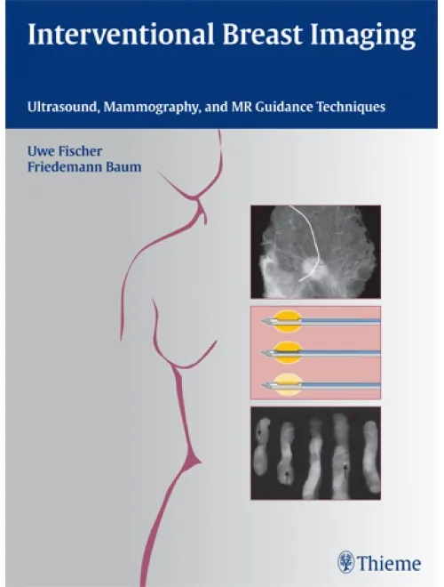 Interventional Breast Imaging - 1st Edition