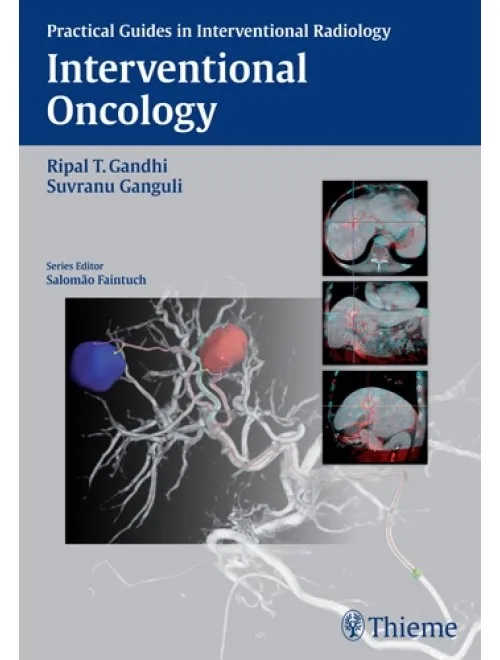 Interventional Oncology - 1st Edition