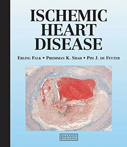 Ischaemic Heart Disease - 1st Edition