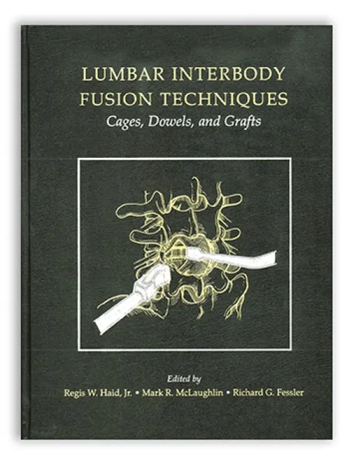 Lumbar Interbody Fusion Techniques: Cages, Dowels, and Grafts - 1st Edition