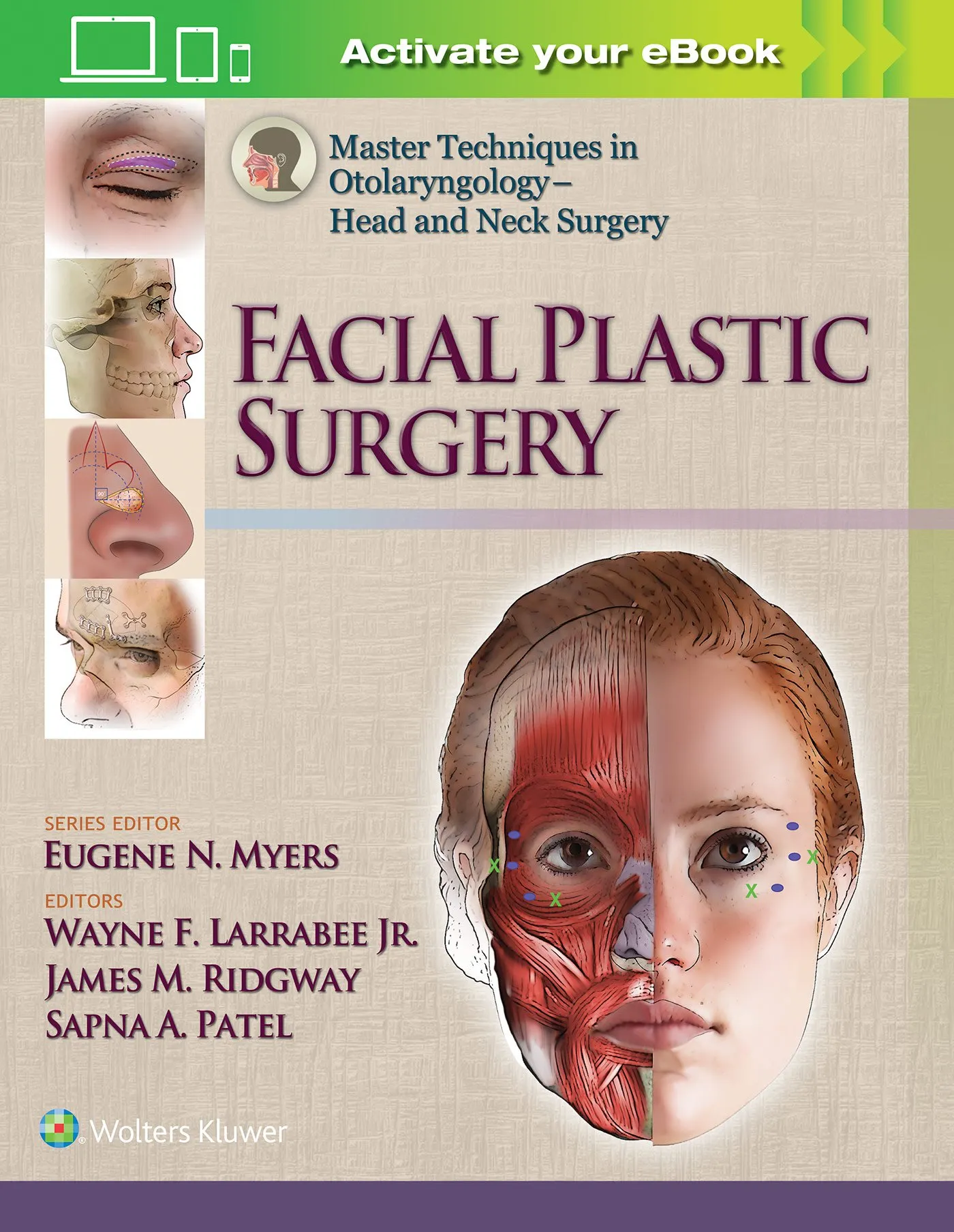 Master techniques in otolaryngology - head and neck surgery | facial plastic surgery