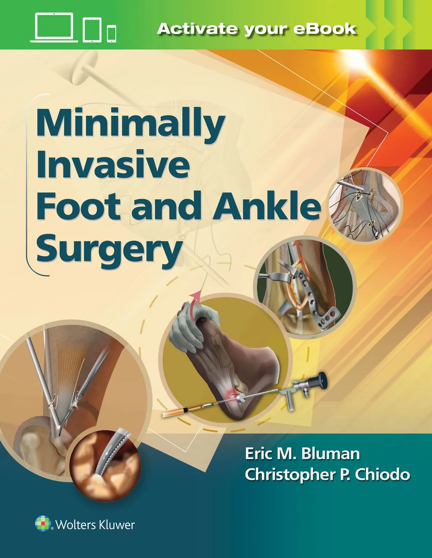 Minimally Invasive Foot and Ankle Surgery - 1st Edition