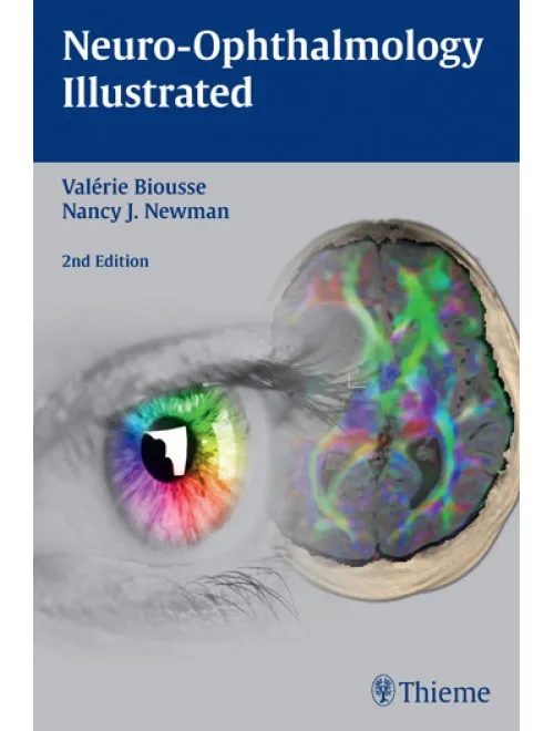 Neuro-Ophthalmology IIIustrated-2nd Edition