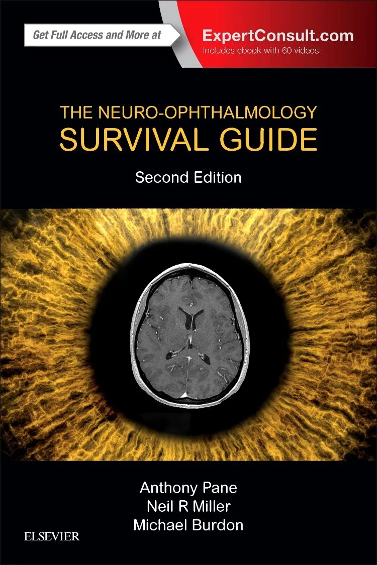 The Neuro-ophthalmology Survival Guide - 2nd Edition