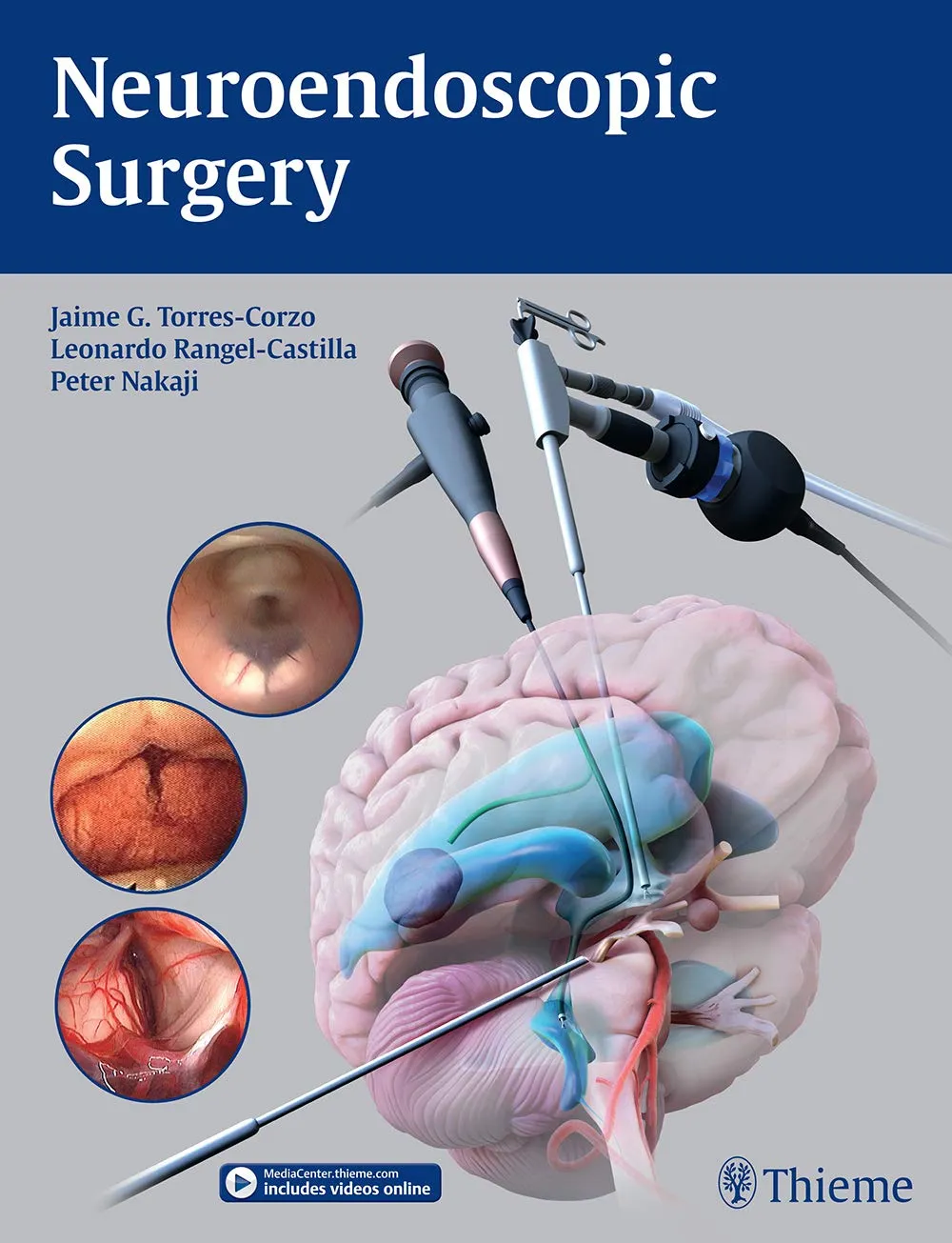 Neuroendoscopic Surgery - 1st Edition