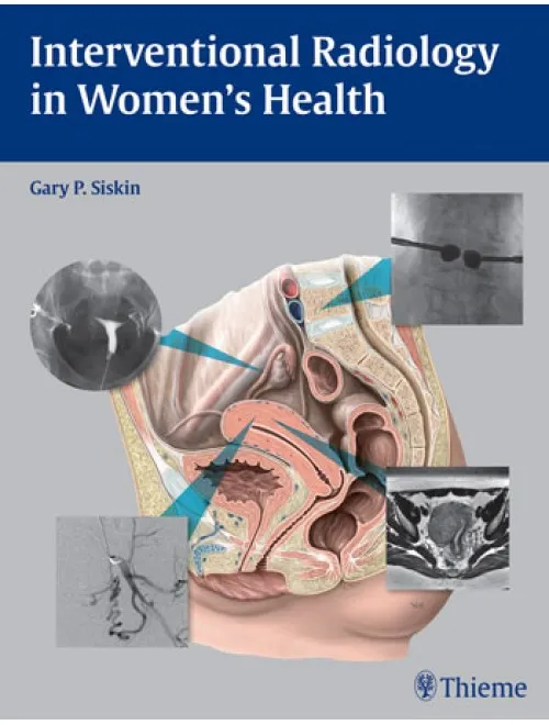 Interventional Radiology In Women's Health - Edition