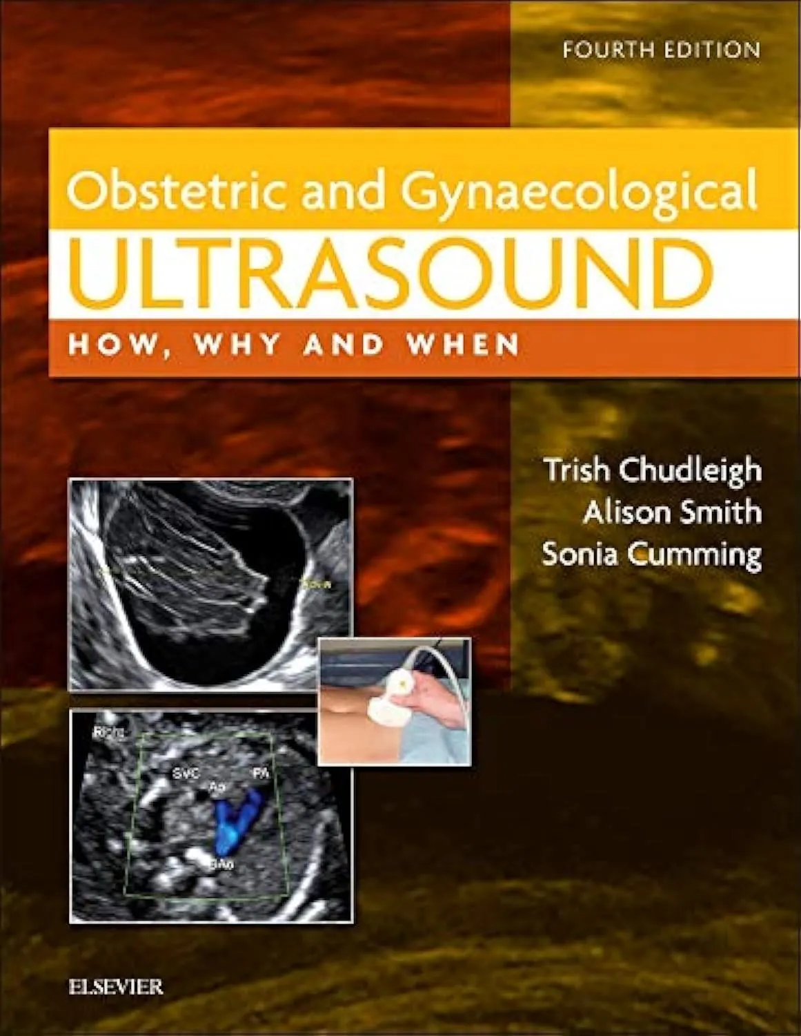 Obstetric & Gynaecological Ultrasound - How Why and When - 4E