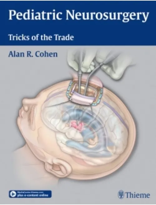 Pediatric Neurosurgery Tricks of the Trade - 1st Edition