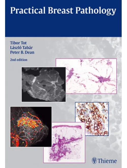 Practical Breast Pathology - 2nd Edition