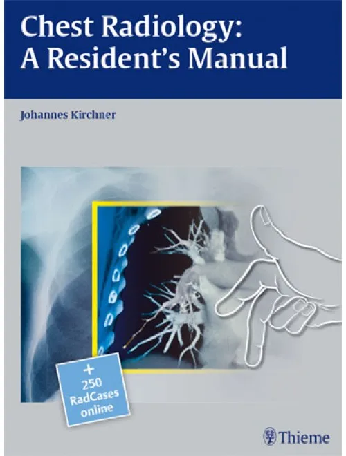 Radcases Chest Radiology A Residents Manual - 1st Edition