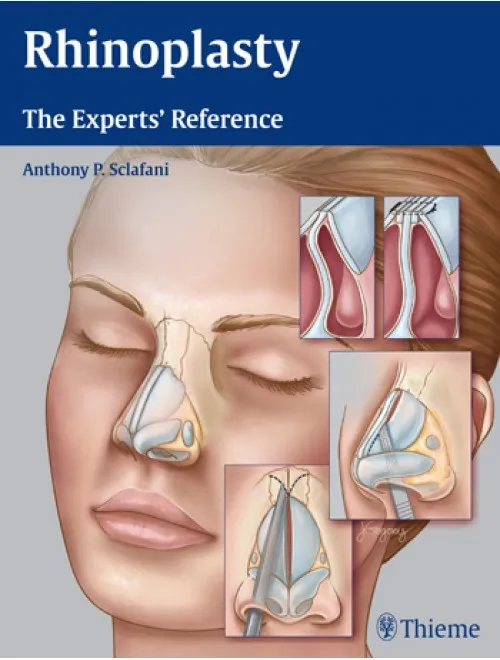 Rhinoplasty The Experts' Reference - 1st Edition