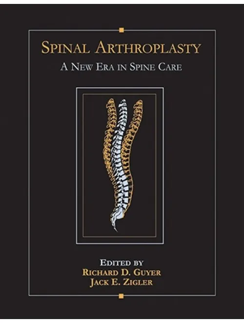 Spinal Arthroplasty - 1st Edition