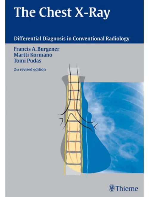The Chest X-Ray - 2nd Edition(Asian Edition)