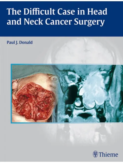 The Difficult Case In Head And Neck Cancer Surgery - 1st Edition