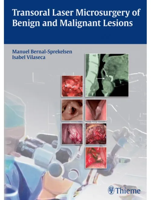 Transoral Laser Microsurgery of Benign and Malignant Lesions - 1st Edition