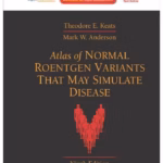 Atlas of Normal Roentgen Variants 9/e