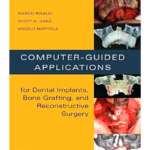 Computer-Guided Applications for Dental Implants, Bone Grafting, and Reconstructive Surgery (adapted translation)