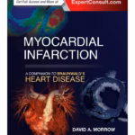 Myocardial Infarction: Companion to Braunwald's Heart Disease - Medical Textbook