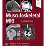 Musculoskeletal MRI - 3rd Edition