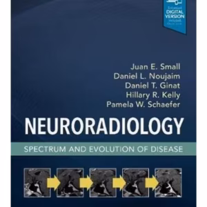 Neuroradiology: Spectrum and Evolution of Disease - 1st Edition