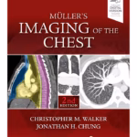 Muller's Imaging of the Chest -2nd Edition