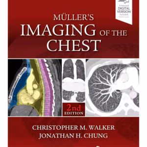Muller's Imaging of the Chest -2nd Edition