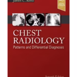 Chest Radiology: Patterns and Differential Diagnoses -7th Edition