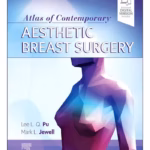 Atlas of Contemporary Aesthetic Breast Surgery-1st Edition