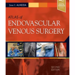 Atlas of Endovascular Venous Surgery: Expert Consult - Online and Print - 2nd Edition