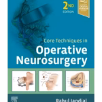 Core Techniques in Operative Neurosurgery: Expert Consult - Online and Print - 2nd Edition