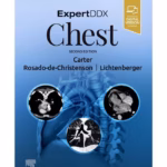 ExpertDDx: Chest-2nd Edition