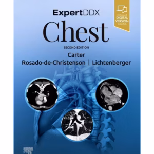 ExpertDDx: Chest-2nd Edition