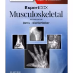 ExpertDDx: Musculoskeletal - 2nd Edition