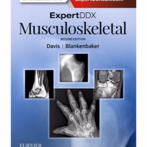 ExpertDDx: Musculoskeletal - 2nd Edition