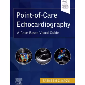 Point-of-Care Echocardiography-1st Edition