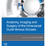 Anatomy, Imaging and Surgery of the Intracranial Dural Venous Sinuses-1st Edition