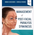 Management of Post-Facial Paralysis Synkinesis-1st Edition