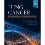 Lung Cancer-1st Edition