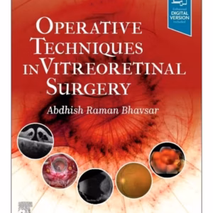 Operative Techniques in Vitreoretinal Surgery-1st Edition