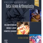 The Technique of Total Knee Arthroplasty-2nd Edition