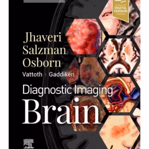 Diagnostic Imaging: Brain-4th EditionD