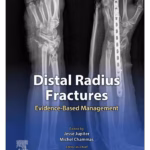 Distal Radius Fractures-1st Edition