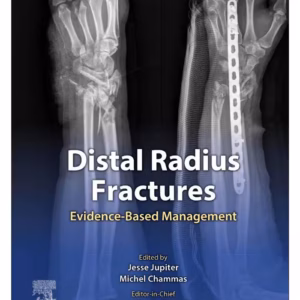 Distal Radius Fractures-1st Edition