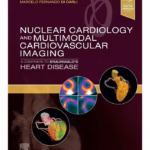 Nuclear Cardiology and Multimodal Cardiovascular Imaging - 1st Edition