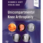 Unicompartmental Knee Arthroplasty-1st Edition