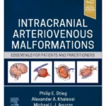 Intracranial Arteriovenous Malformations: Essentials for Patients and Practitioners - 1st Edition