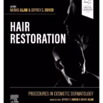 Procedures in Cosmetic Dermatology: Hair Restoration-1st Edition