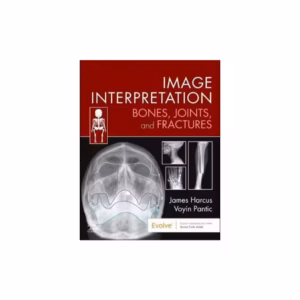 Image Interpretation: Bones, Joints, and Fractures - 1st Edition