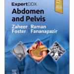 ExpertDDx: Abdomen and Pelvis-3rd Edition